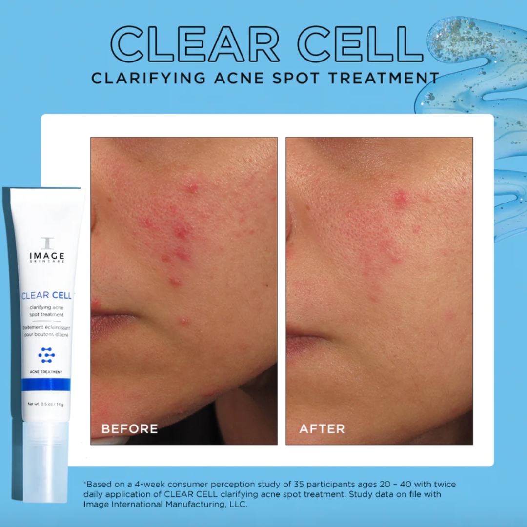 IMAGE SKINCARE CLARIFYING SALICYLIC BLEMISH GEL